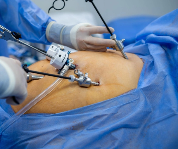 Identify Unusually Complex Procedures
