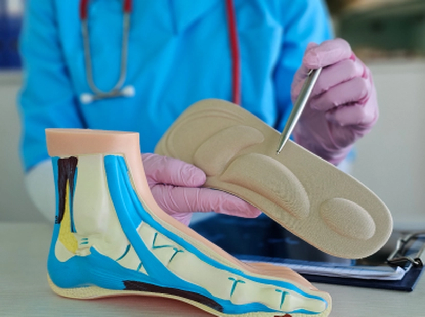 Podiatrist holding a custom orthotic insole next to a foot arch model